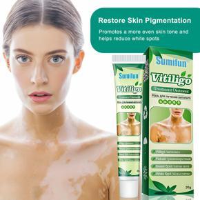 Sumifun Vitiligo Treatment Ointment 20g