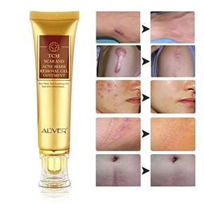 TCM Acne Scar Removal Cream 20ml